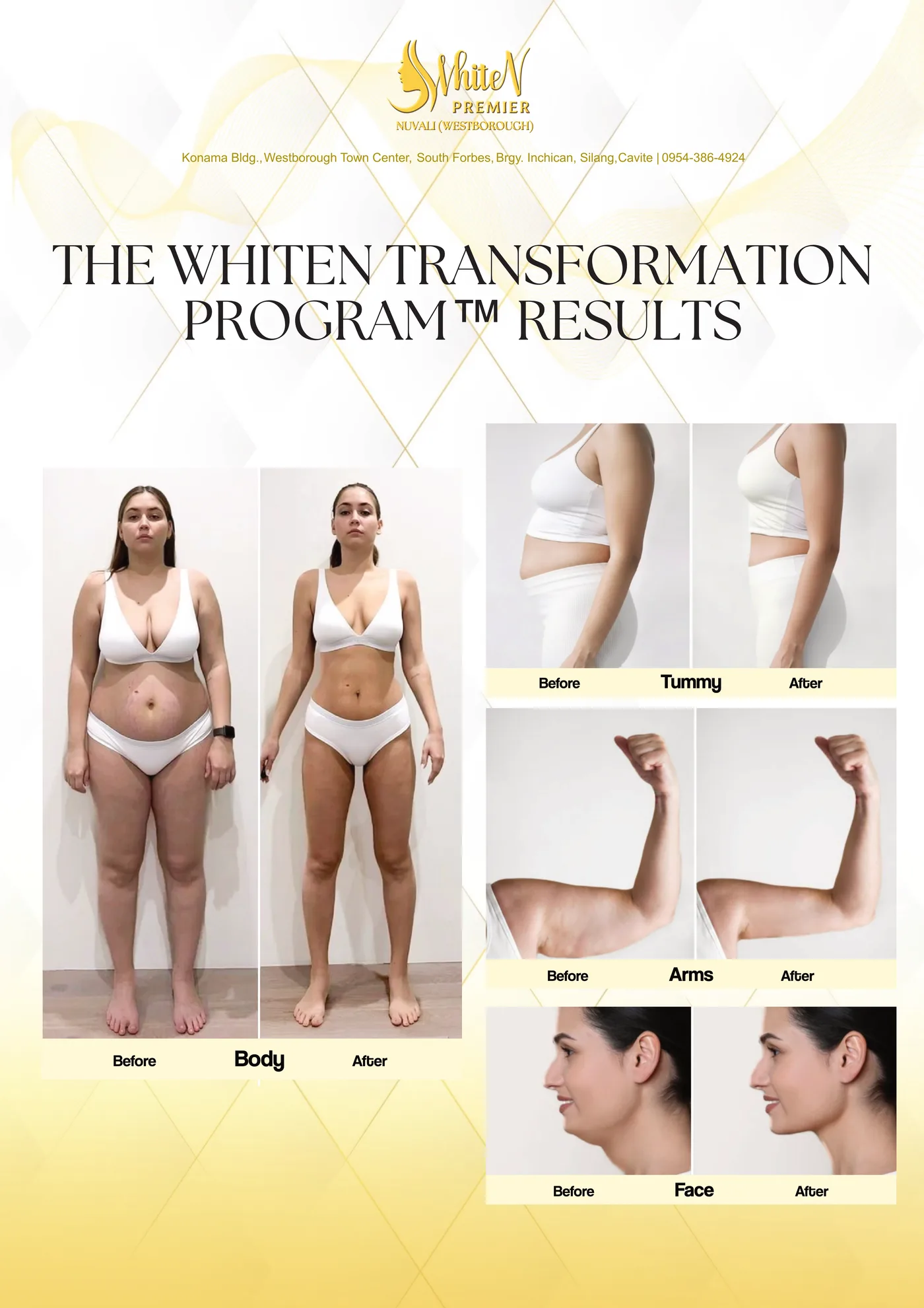 Whiten Transformation Program™ results, before and after: body, tummy, arms, face